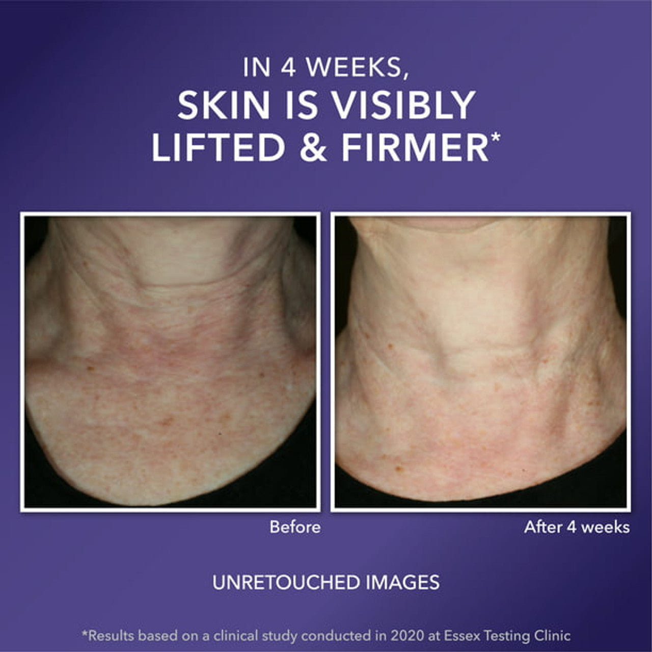 RoC Multi Correxion Anti-Aging Moisturizer, Firming Cream for Dry & Crepey Skin, 1.7 oz - GOODSZON Discount Store