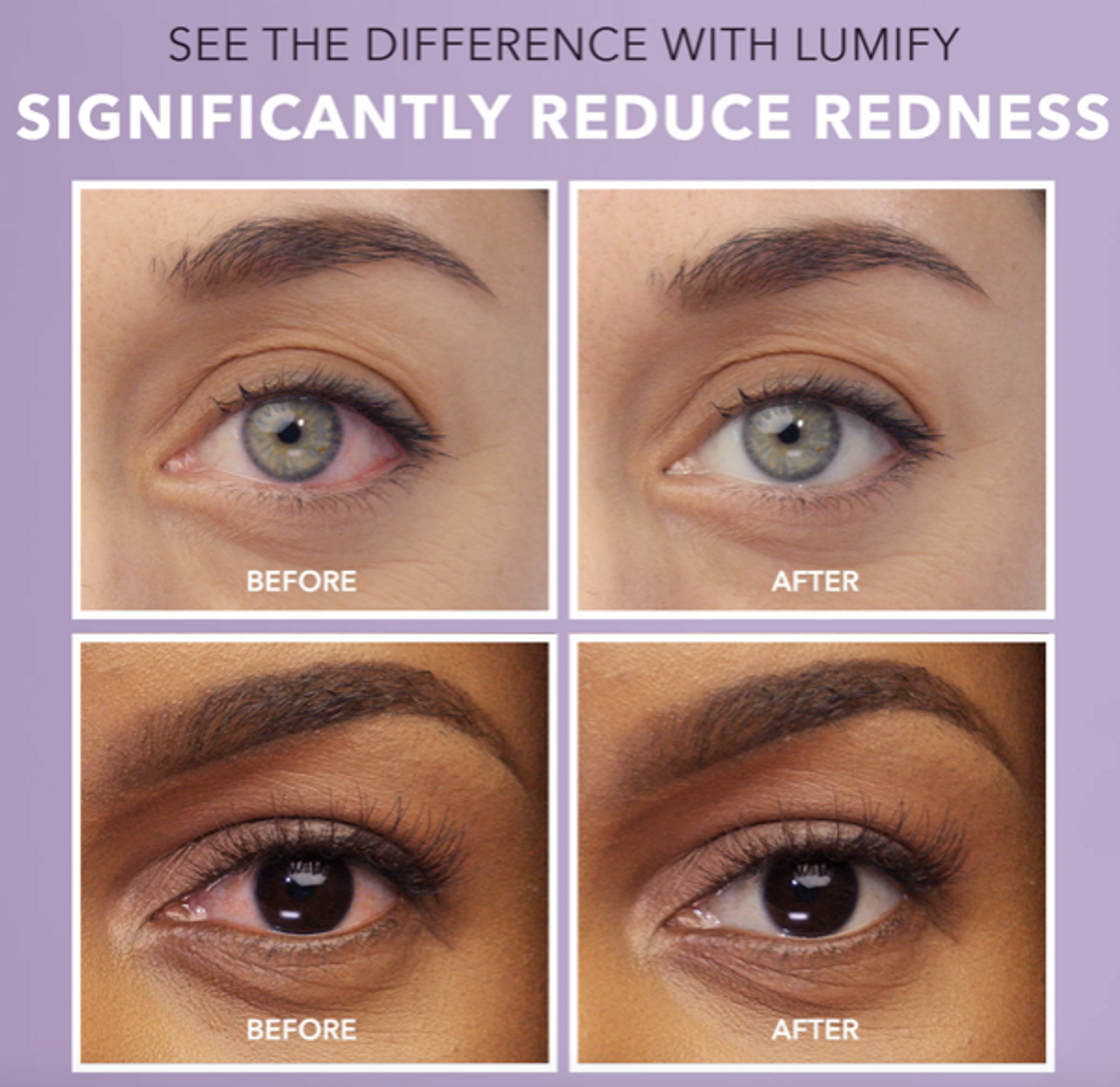 Lumify Redness Reliever Eye Drops - .25 Oz / 7. 5 Ml - GOODSZON Discount Store