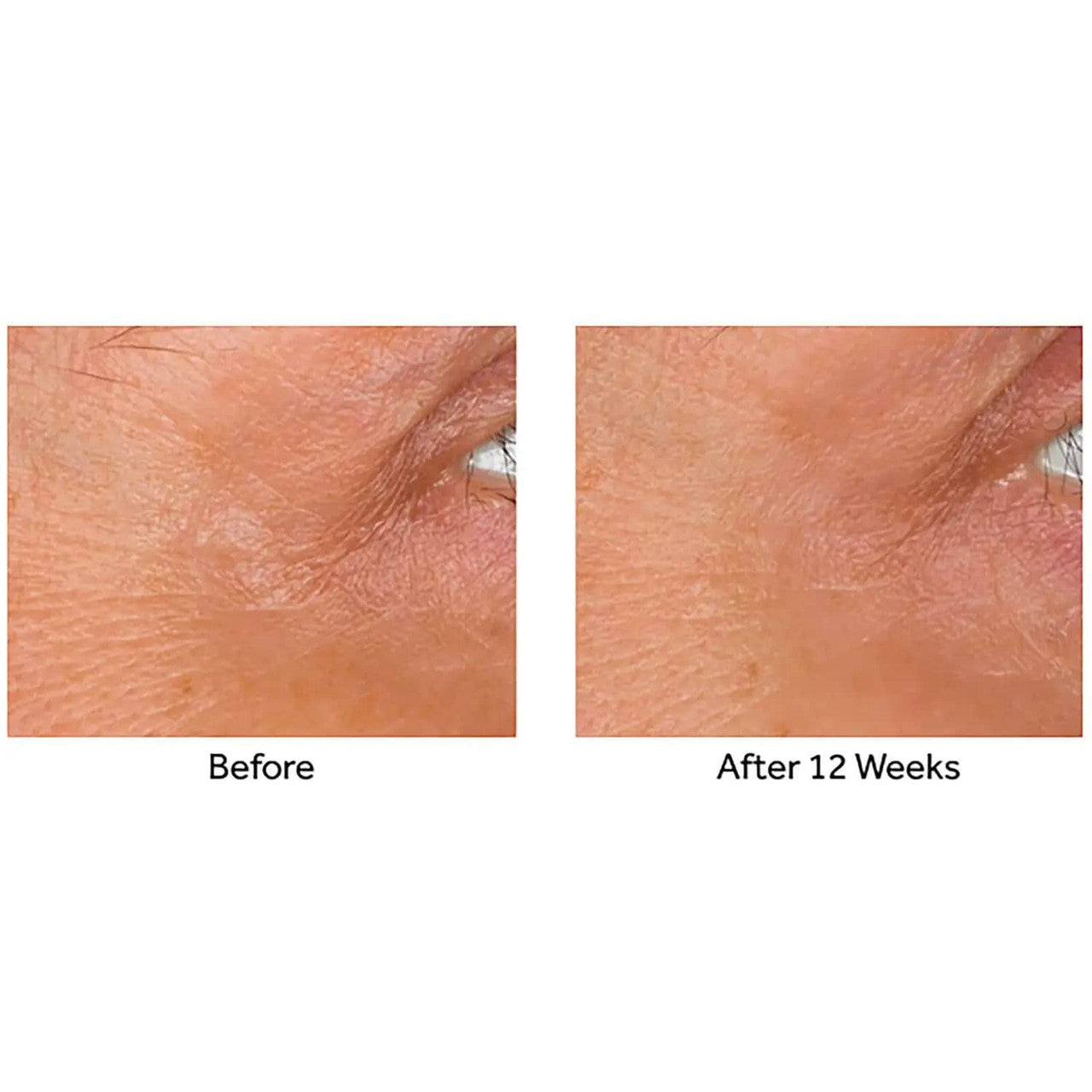 No7 Laboratories Line Correcting Booster Serum 0.5 fl oz/ 15 mL - GOODSZON Discount Store