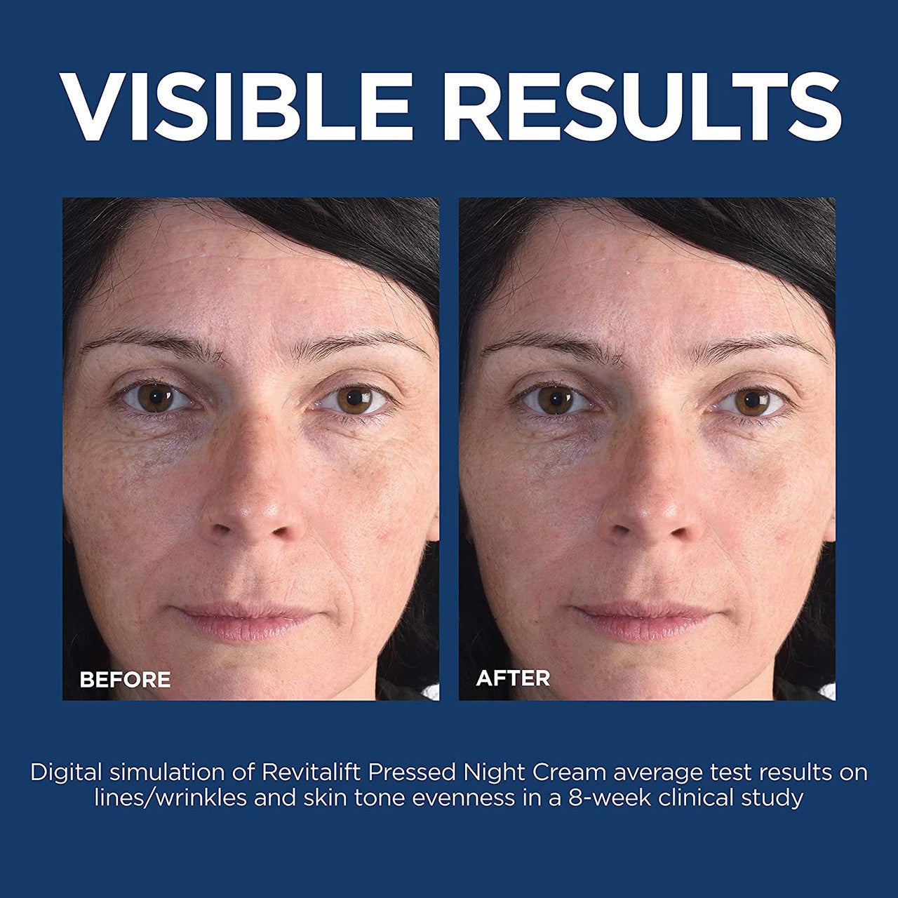 L'Oreal Paris Revitalift Caring Micro Hyaluronic Acid, Ceramides Plumping Cream, 1.7 oz - GOODSZON Discount Store