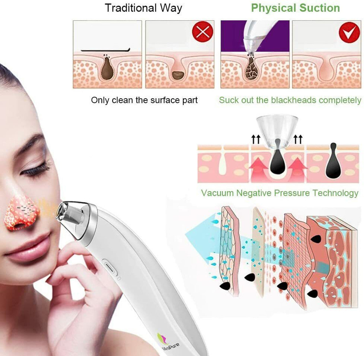 MiroPure Electric Facial Skin Care Blackhead Remover Facial Pore Cleaner Vacuum - GOODSZON Discount Store