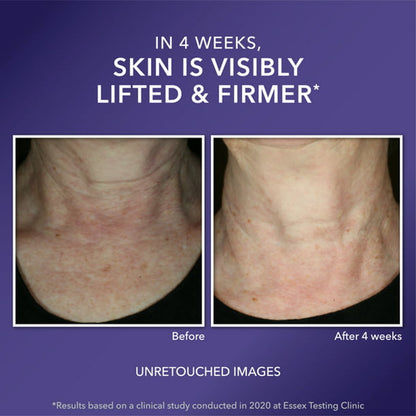 RoC Multi Correxion Anti-Aging Moisturizer, Firming Cream for Dry & Crepey Skin, 1.7 oz - GOODSZON Discount Store