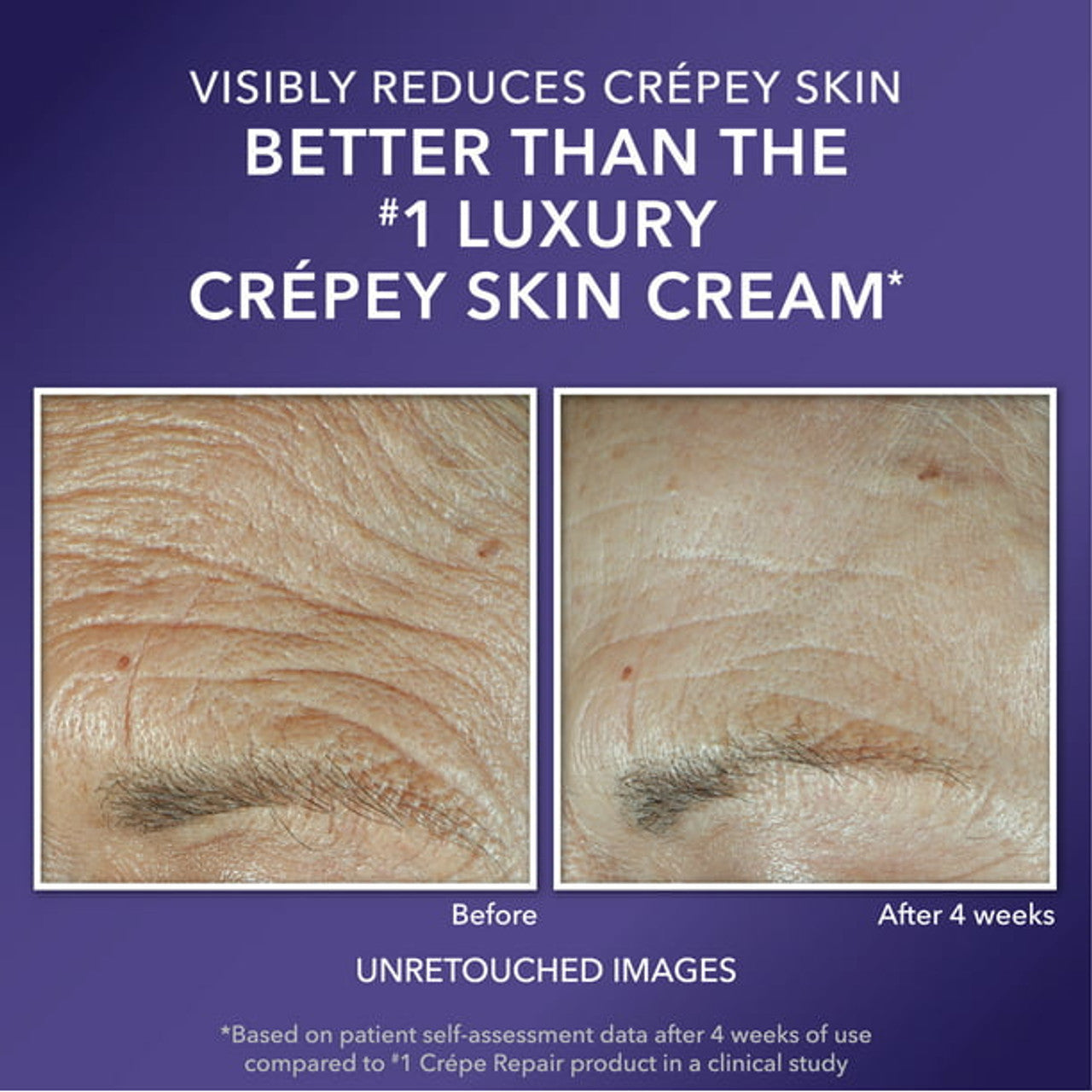 RoC Multi Correxion Anti-Aging Moisturizer, Firming Cream for Dry & Crepey Skin, 1.7 oz - GOODSZON Discount Store